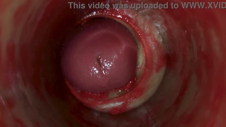 Camera Inside Deep Pussy Captures Huge Ejaculation of Sperm ASMR 5 min